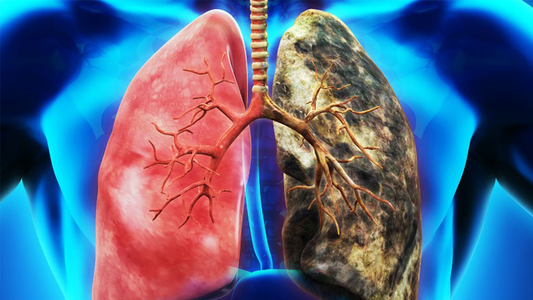 Acupuncture or Moxibustion? The Best Traditional Chinese Therapy for Cancer Support
